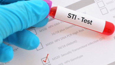 STD Testing Near Me