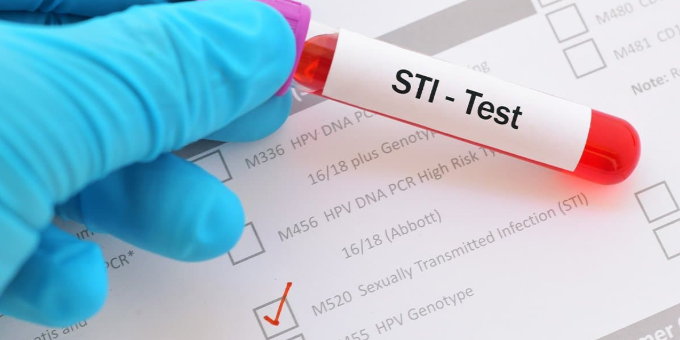 STD Testing Near Me